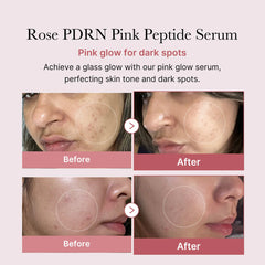 Medicube PDRN Pink Peptide Serum 30ml