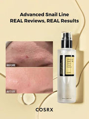 Cosrx Advanced Snail 96 Mucin power Essence 100ml
