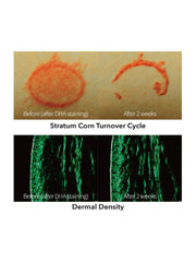 Rejuran Turnover Ampoule c-pdrn 0.5%