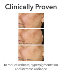Dr.dennis Gross Alpha Beta® Universal Daily Peel 2.2ml