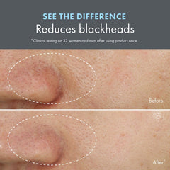 Clear Improvement™
Blackhead Clearing Mask-To-Scrub 15ml