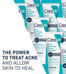 Cerave Acne Foaming Cream Cleanser 4% benzoyl peroxide acne treatment 5oz