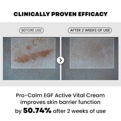 Hanmi Pro-Calm EGF Active Vital Cream 20ml