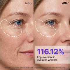 Sungboon Silk Peptide EGF Intensive Gold Mask 37g