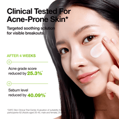Anua Azelaic Acid CICA Skin Soothing Moisturizer 100ml