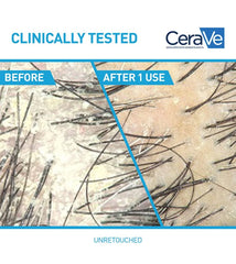 CeraVe 2-in-1 Anti-Dandruff Hydrating Shampoo and Conditioner