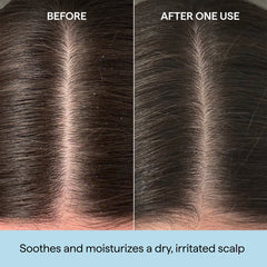 BRIOGEO
SCALP REVIVALT™ ROSEMARY PRE-WASH OIL