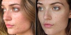 Murad InvisiScar Resurfacing Treatment 30ml
