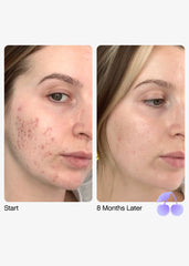 Topicals Faded Brightening Serum and clearing serum for Dark Spots & Discoloration 15ml