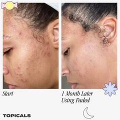 Topicals Faded Brightening Serum and clearing serum for Dark Spots & Discoloration 50 ml