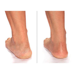 ADVANCED CLINICALS Cracked Heel Cream 237ml