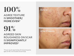 Murad InvisiScar Resurfacing Treatment 30ml