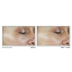 ROC MULTI CORREXION® REVIVE + GLOW MOISTURIZER SPF 30