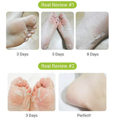 Purederm Shiny And Soft Foot Peeling Mask (1 pair)