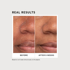 NIACINAMIDE SERUM 12% PLUS ZINC 2%