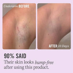 First Aid Beauty
Ingrown Hair Pads with BHA & AHA