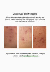 VEMONTES Axcne Booster Cream 25ml