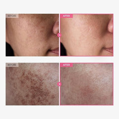 TOSOWOONG Arbutin 7% + Tranexamic Acid 4% Cream For Dark Spots, Brightening 50ml