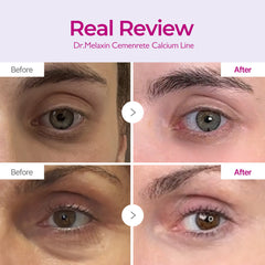 Dr.Melaxin Cemenrete Calcium Volume Cream