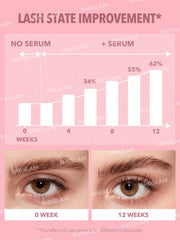 Sheglam Gro-Pro Nourishing Lash Serum 2.4ml