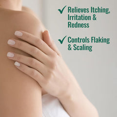 Nizoral Psoriasis Relief Cream 113g