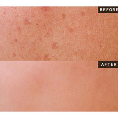 HEVEBLUE Single Vita Dark Spot Pine-Ampoule