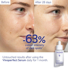 Caudalíe Vinoperfect
Dark Spot Brightening Serum Vitamin C Alternative - 30ml