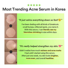 Abib Heartleaf Teca Capsule Serum Calming Drop