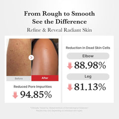 Medicube Hypochlorous Acid Body Peel Shot 280ml