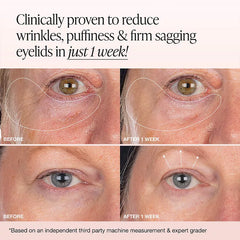 iNNBEAUTY PROJECT Extreme Cream Eye Firming & Contouring Refillable Eye Cream 7ml