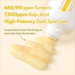 TOSOWOONG Kojic Acid Turmeric Cream for Dark Spots & Hyperpigmentation 50ml