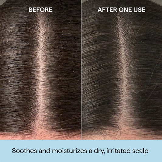 BRIOGEO

SCALP REVIVALT™ ROSEMARY PRE-WASH OIL