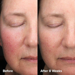 Paula's Choice 6% Mandelic + 2% Lactic Acid AHA Liquid Exfoliant - 30ml