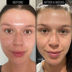 THE INKEY LIST EXCESS OIL SOLUTION
20% NIACINAMIDE SERUM 30ml
