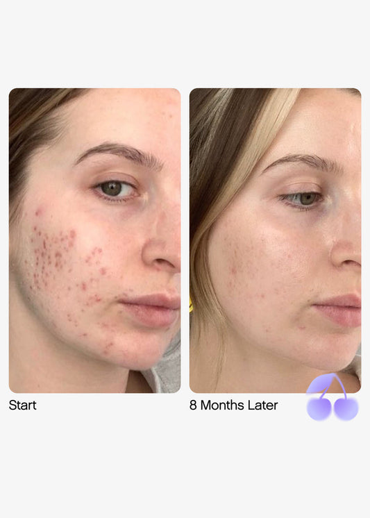 Topicals Faded Brightening Serum and clearing serum  for Dark Spots & Discoloration 15ml