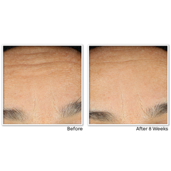 RETINOL CORREXION Line Smoothing Night Serum Capsules (30 biodegradable caps)