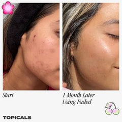 Topicals Faded Brightening Serum and clearing serum  for Dark Spots & Discoloration 50 ml